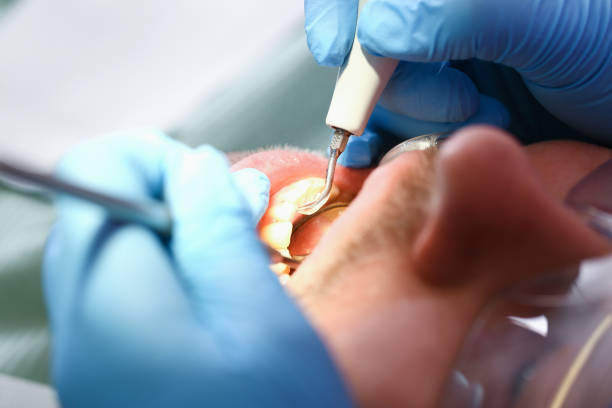 Best Urgent Dental Care for Toothaches in Fort Irwin, CA