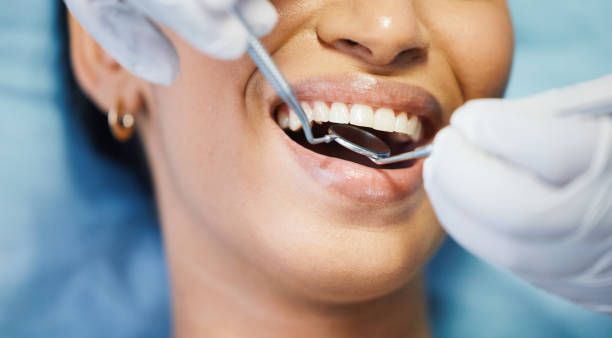 Best Emergency Dental Care for Sports Injuries in Fort Irwin, CA