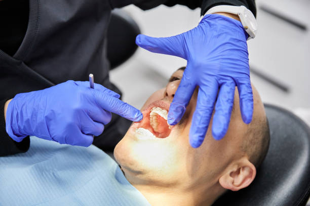 Best Dental Abscess Treatment in Fort Irwin, CA